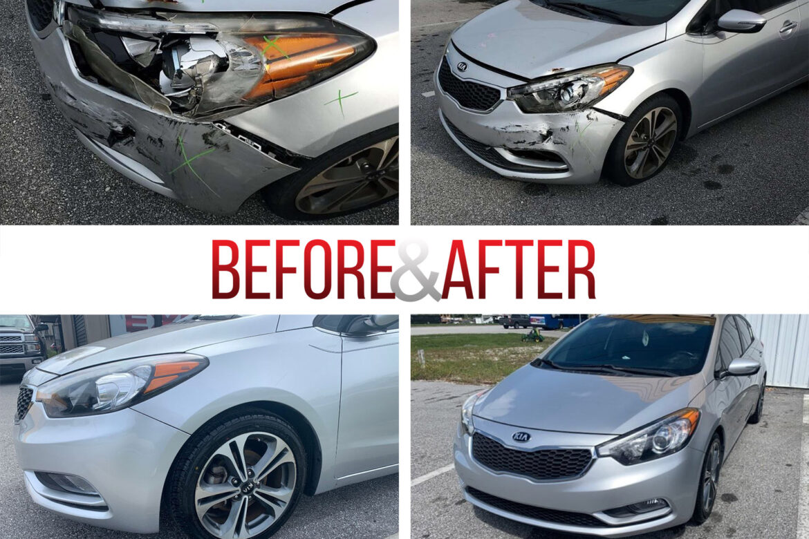 Before/After. 2015 KIA Forte