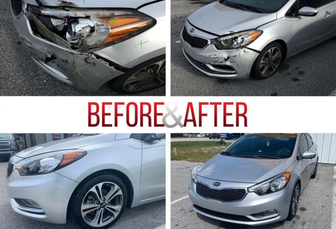 Before/After. 2015 KIA Forte