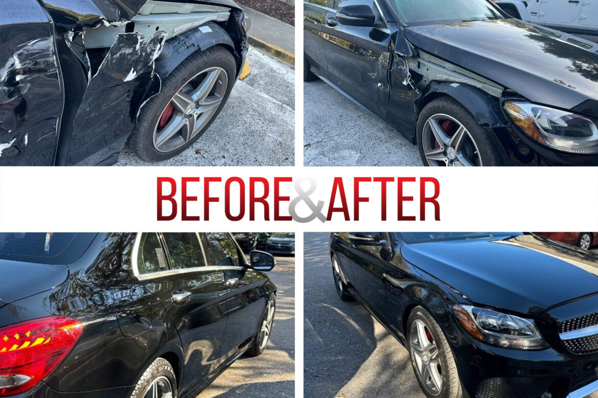 Before/After. 2016 Mercedes C300