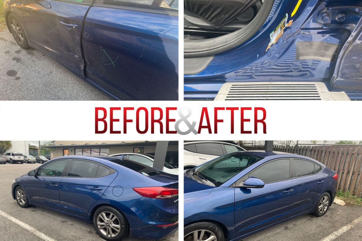 Before/After. 2017 Hyundai Elantra
