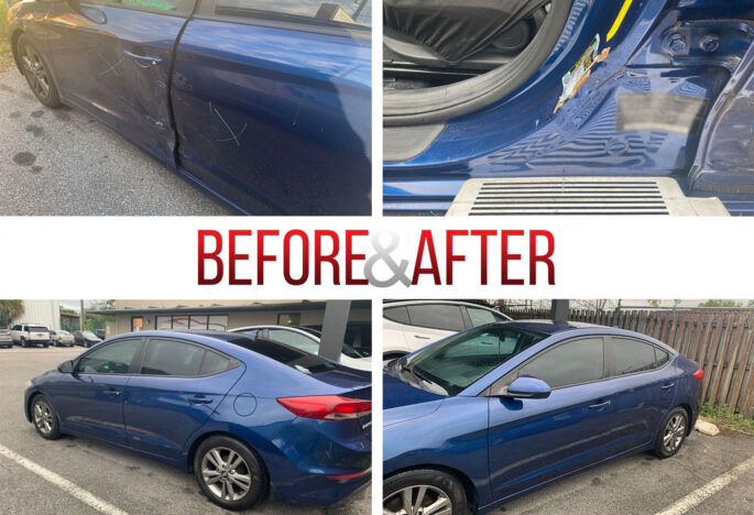 Before/After. 2017 Hyundai Elantra