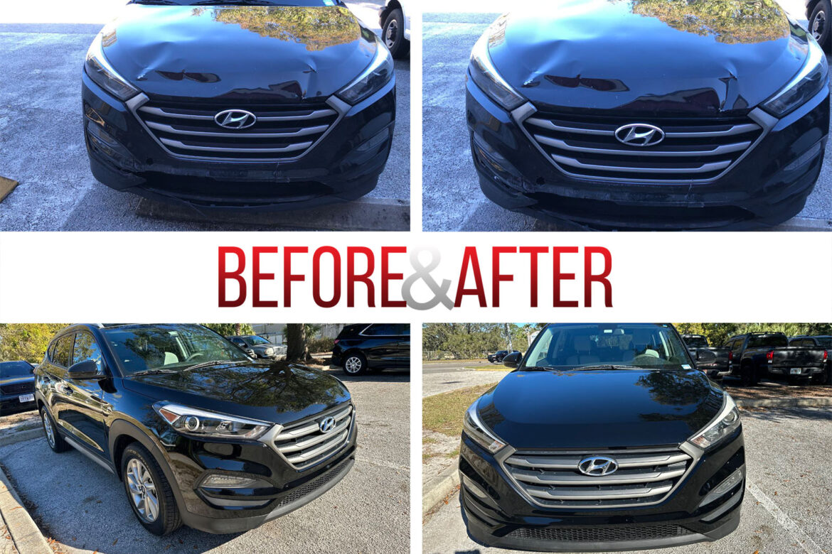 Before/After. 2017 Hyundai Tucson