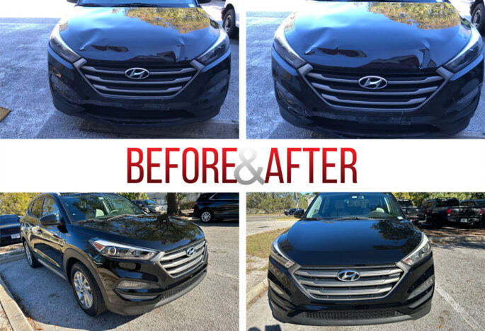 Before/After. 2017 Hyundai Tucson